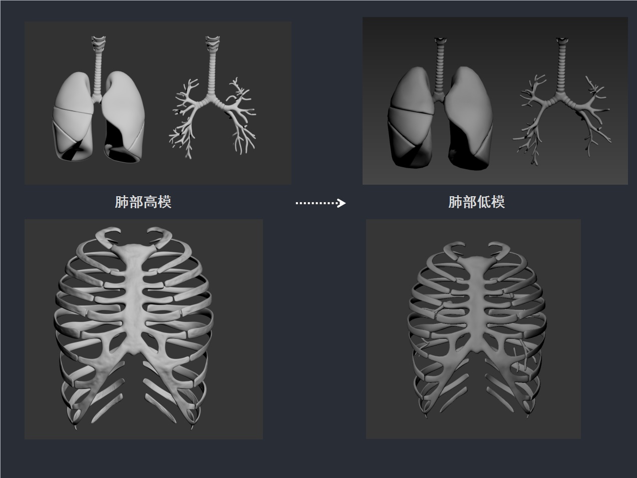 专业的设计流程是怎样的?来看腾讯的医学可视化探索案例!